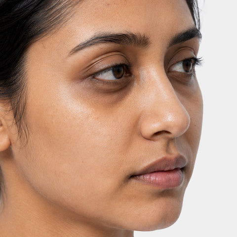 Dull and tired skin
