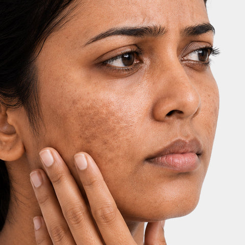 Dark spots and pigmentation
