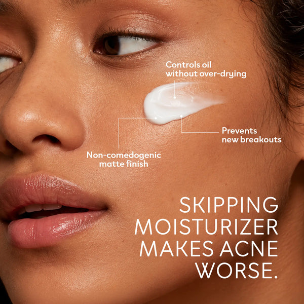 Morning Bloom Anti-Acne Moisturizer