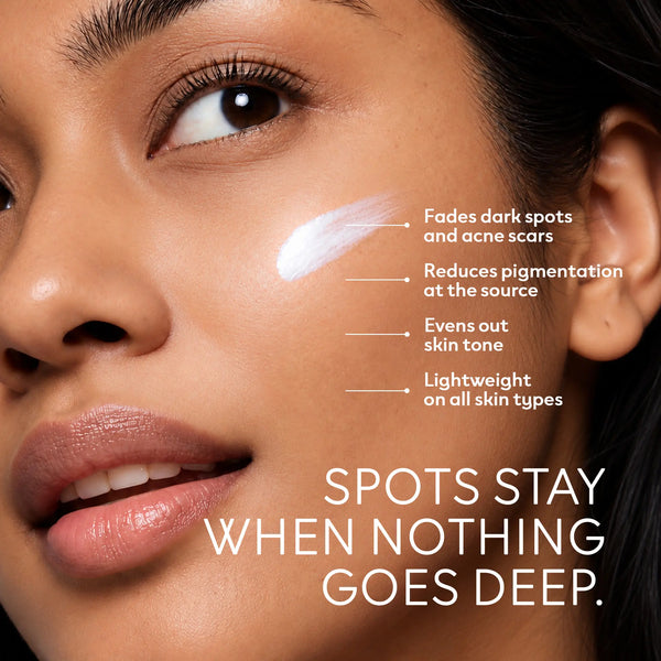 Spot Removal Cream