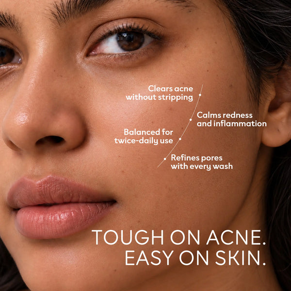 Anti Acne Face Cleanser